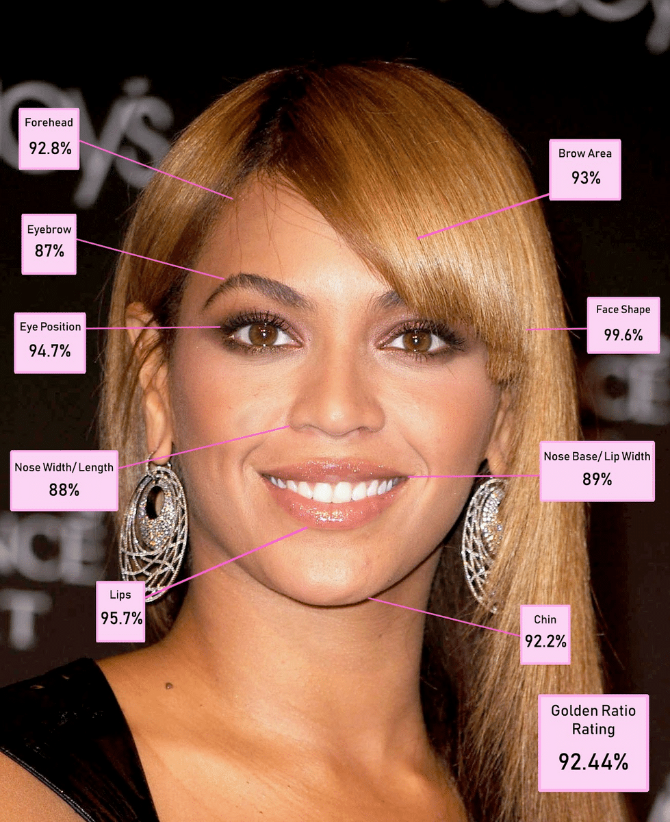 Beyonce has a nice nose with just enough fullness at the tip. For this reason, patients love her natural-looking nose. 