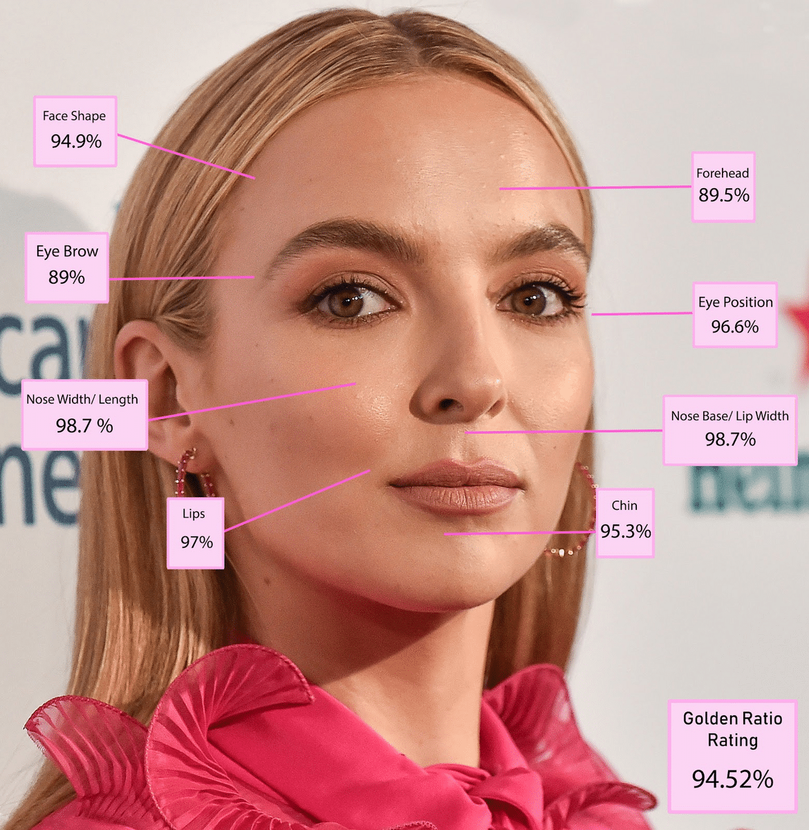 Patients admire Jodie Comer’s precise upturn of the tip. For this reason, many patients love Comer’s nose. 