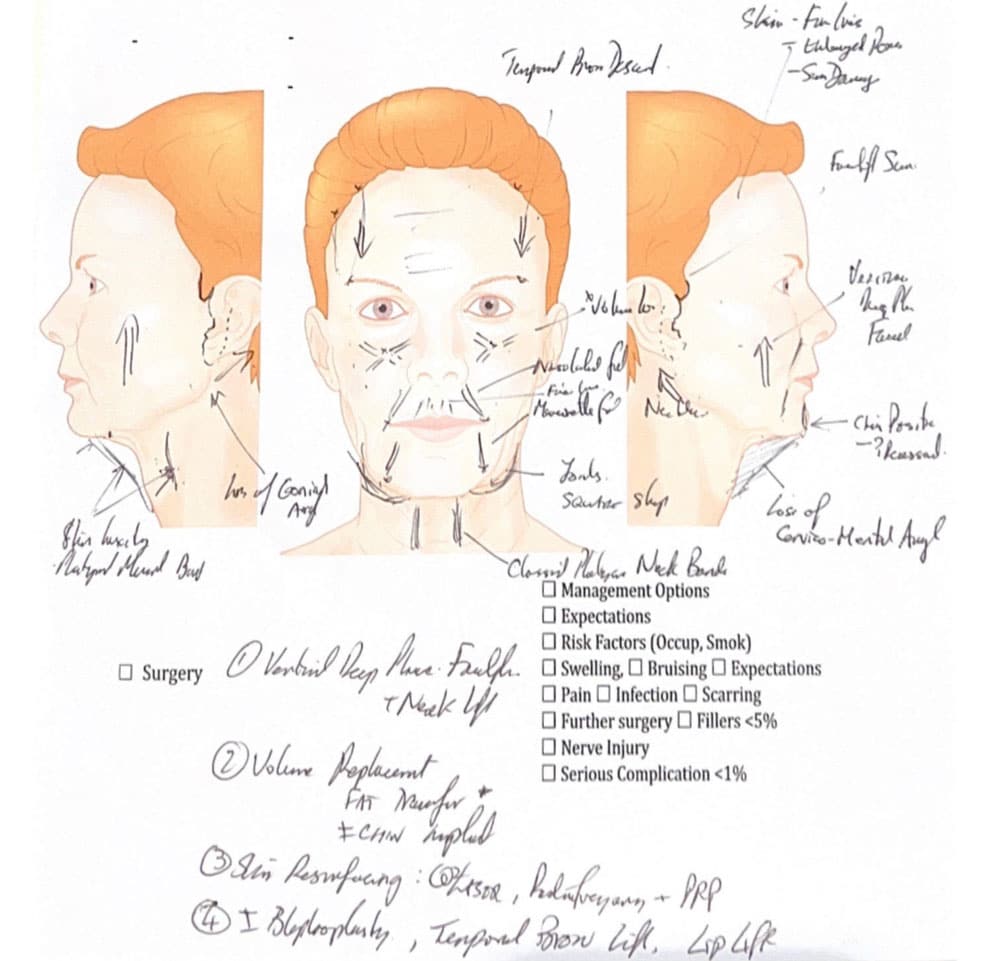 Facial Mapping - facial areas illustration